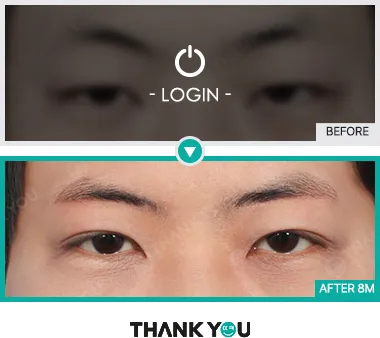 Before/After
