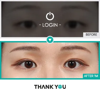 Before/After