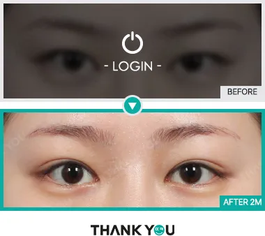 Before/After