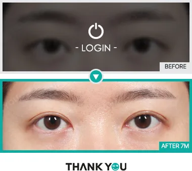 Before/After