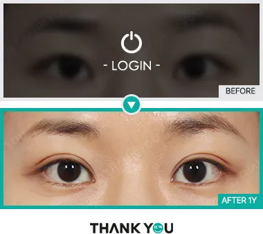 Before/After