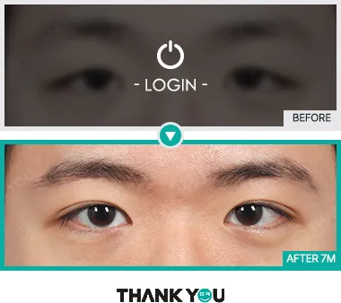 Before/After