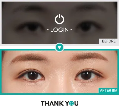 Before/After