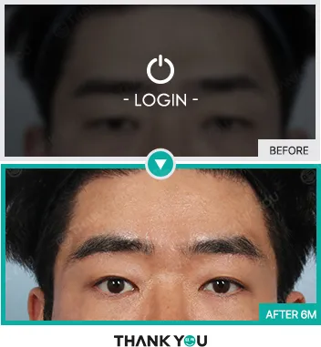 Before/After