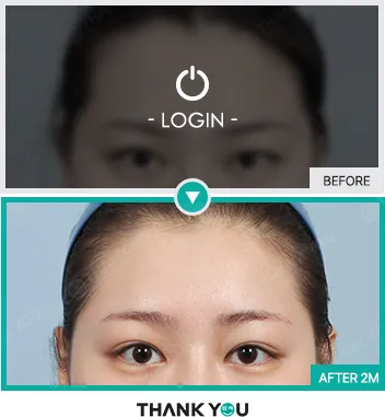 Before/After