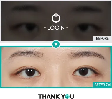 Before/After