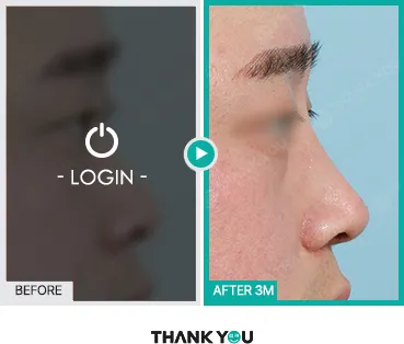 Before/After
