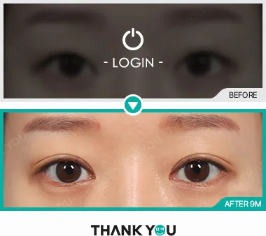 Before/After