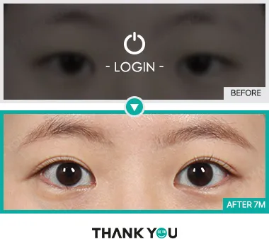 Before/After