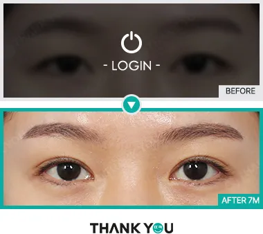 Before/After