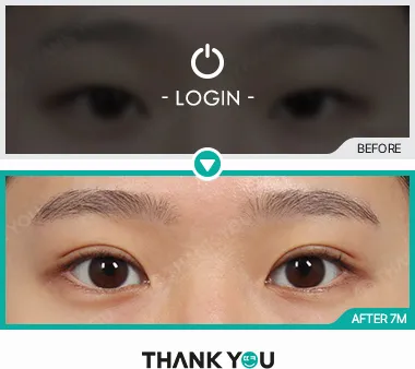 Before/After