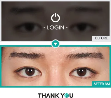 Before & After
