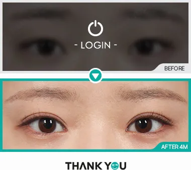 Before/After