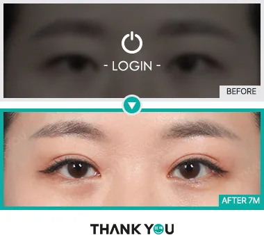 Before/After