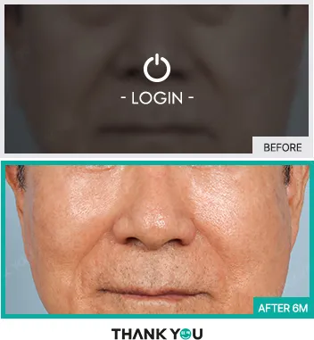 Before/After