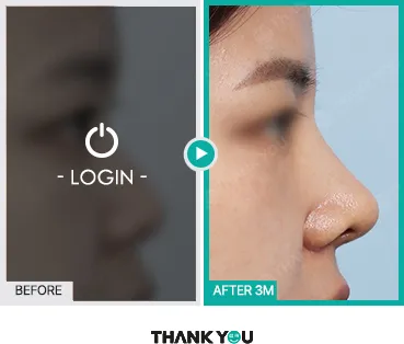 Before/After