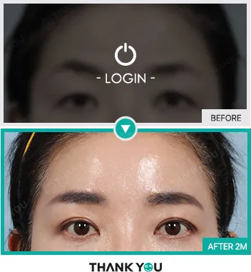 Before & After