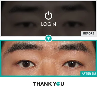 Before/After