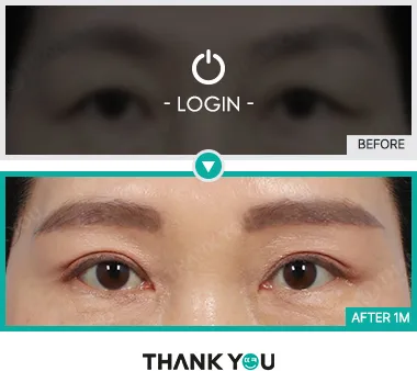 Before/After