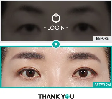Before & After