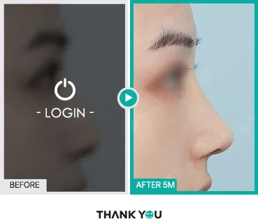 Before/After