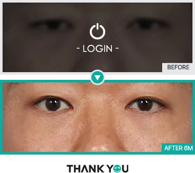 Before & After
