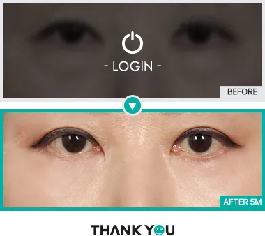 Before/After