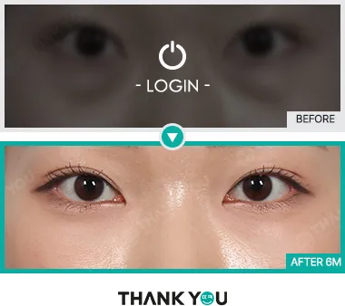 Before/After