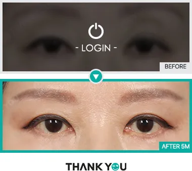 Before/After