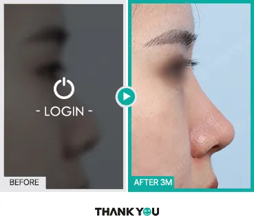 Before/After