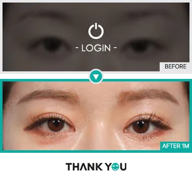 Before/After