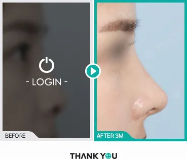 Before/After