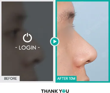 Before/After