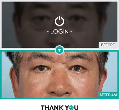 Before/After