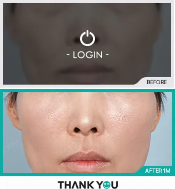 Before/After