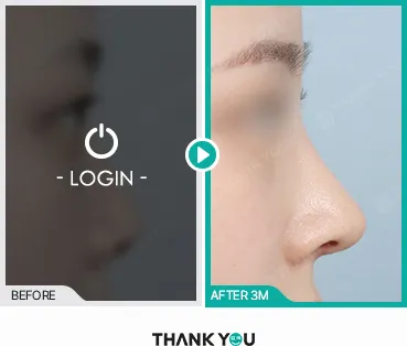 Before/After