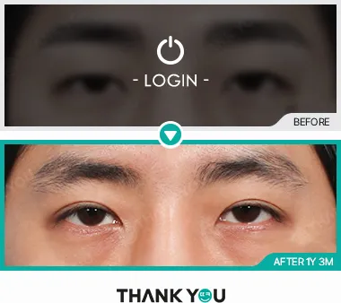Before/After