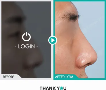 Before/After