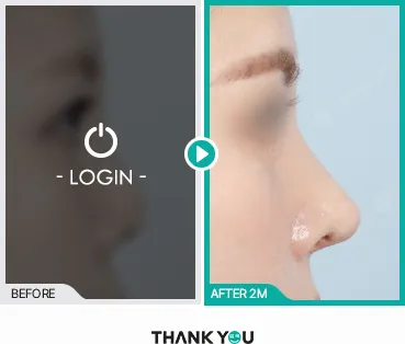 Before/After