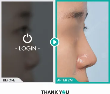 Before/After
