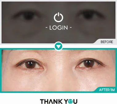 Before/After