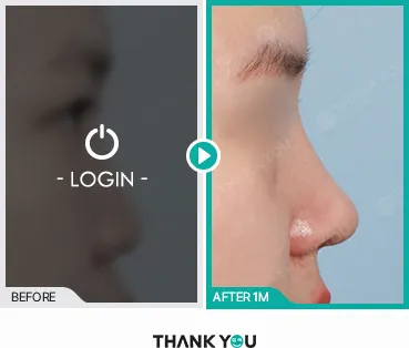 Before/After