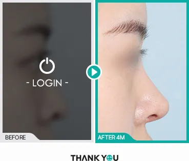 Before/After