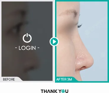 Before/After