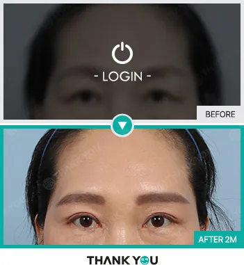 Before/After