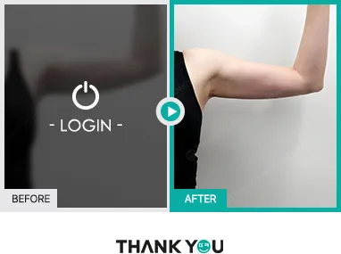 Before/After