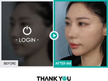 Before/After