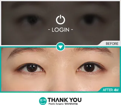 Before/After