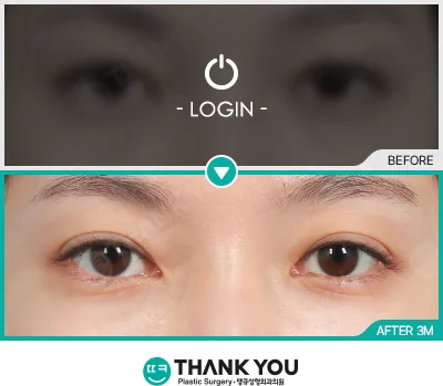 Before/After