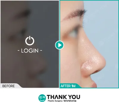 Before/After